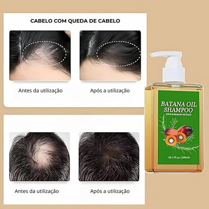 Champô Nutritivo com Batata Doce e Óleo de Alecrim 300 Ml (OFERTA 2X1)